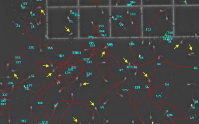 La UCLM colabora en el software informático abierto ‘Sperm Motility Tracker’